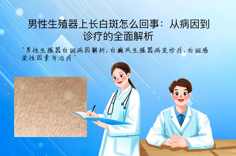 男性生殖器上长白斑怎么回事：从病因到诊疗的全面解析