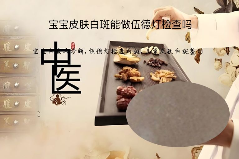 宝宝皮肤白斑能做伍德灯检查吗”