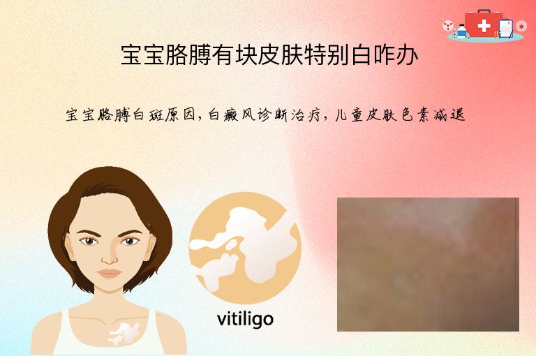 宝宝胳膊有块皮肤特别白咋办”