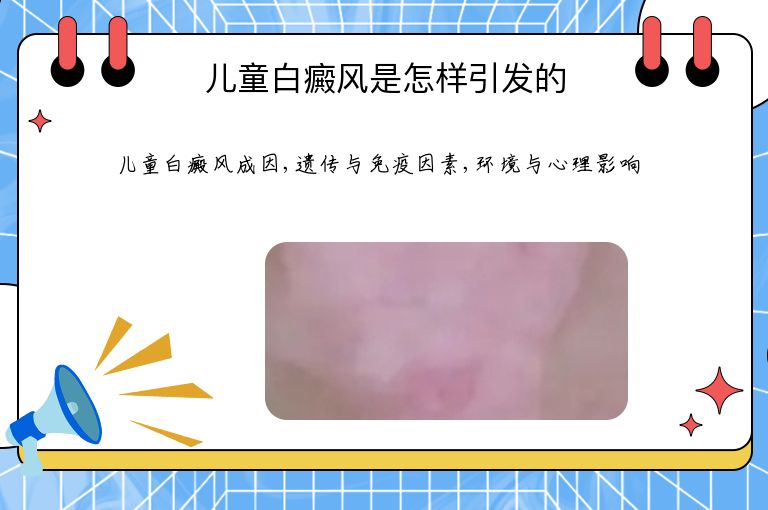 儿童白癜风是怎样引发的”
