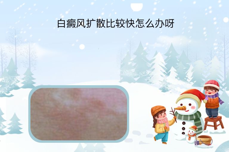 https://www.bdfsjzyy.com/d/file/p/2e17add44850ec950faeed79dbd407cb.jpeg