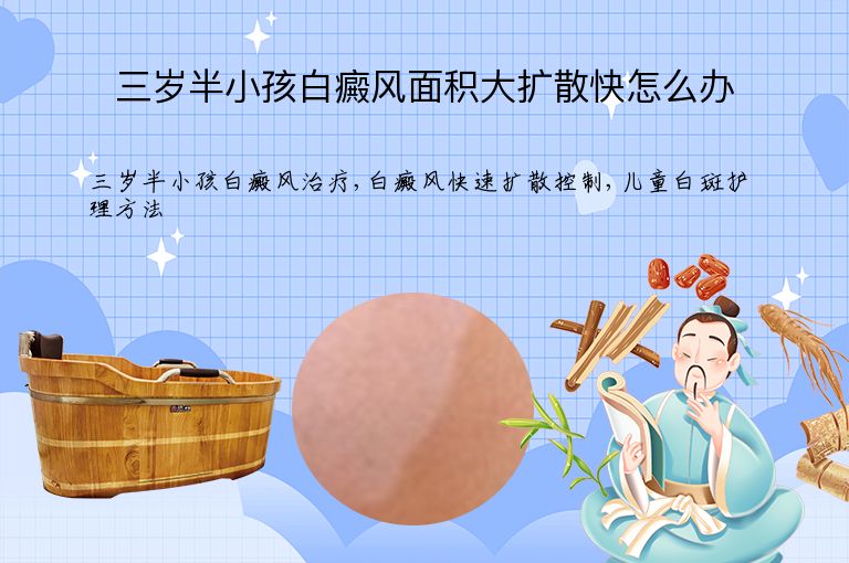 三岁半小孩白癜风面积大扩散快怎么办”