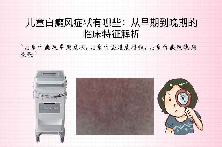 儿童白癜风症状有哪些：从早期到晚期的临床特征解析