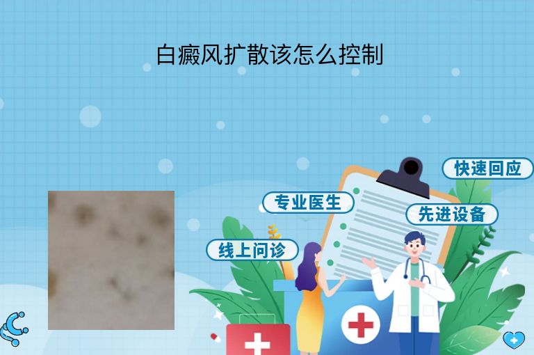 https://www.bdfsjzyy.com/d/file/p/b86a31a1968a3f4db27ffcd3c262ec64.jpeg