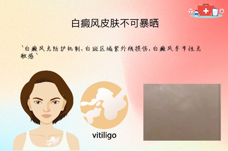 白癜风皮肤不可暴晒