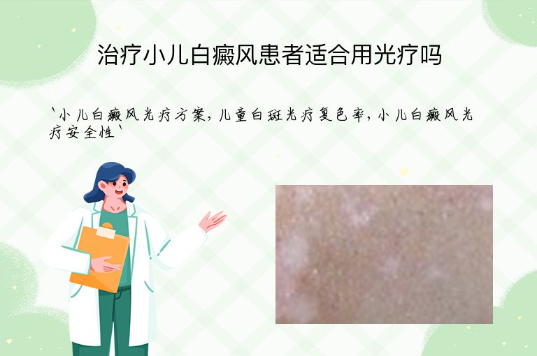治疗小儿白癜风患者适合用光疗吗