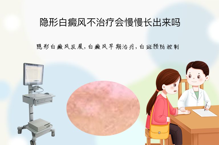 隐形白癜风不治疗会慢慢长出来吗”