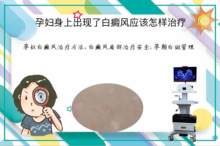 孕妇身上出现了白癜风应该怎样治疗”