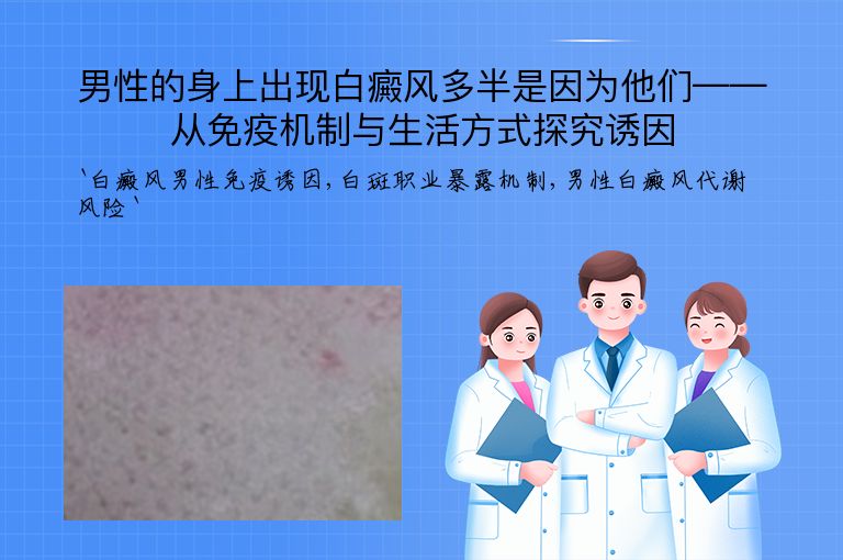 男性的身上出现白癜风多半是因为他们——从免疫机制与生活方式探究诱因