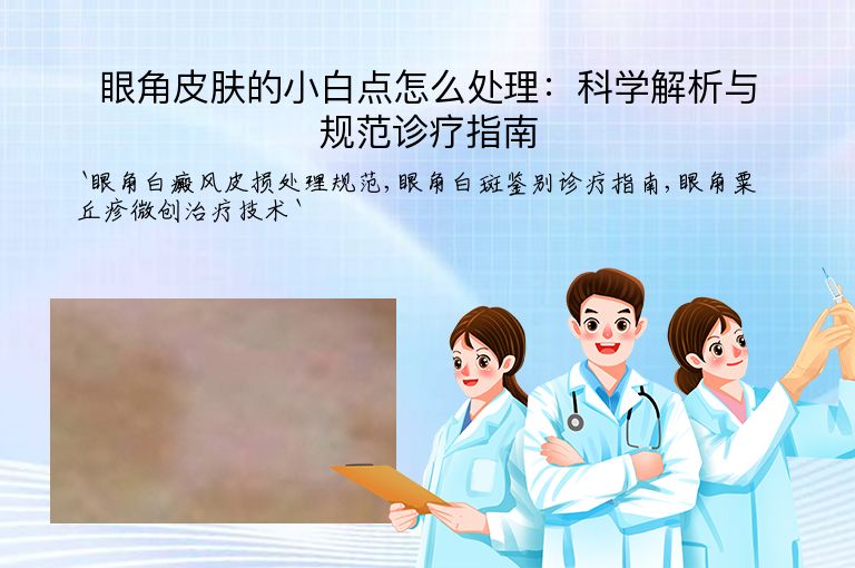 眼角皮肤的小白点怎么处理:科学解析与规范诊疗指南