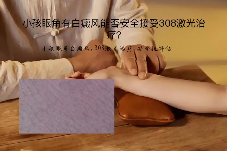 小孩眼角有白癜风能否安全接受308激光治疗？”