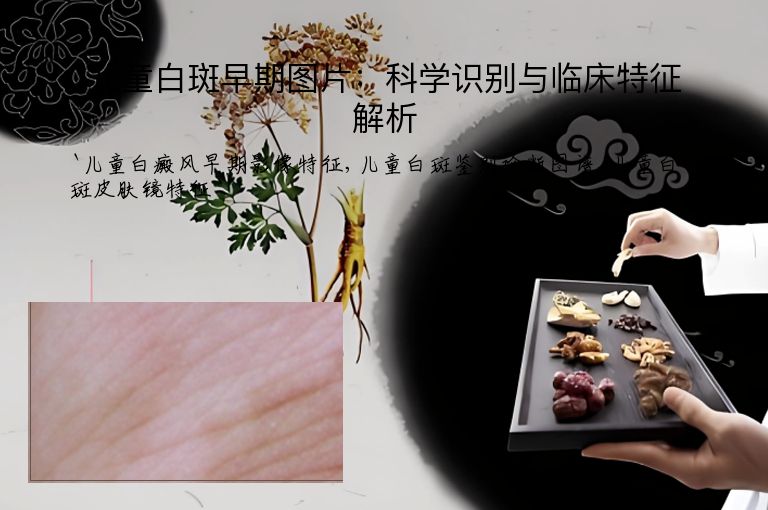 儿童白斑早期图片：科学识别与临床特征解析