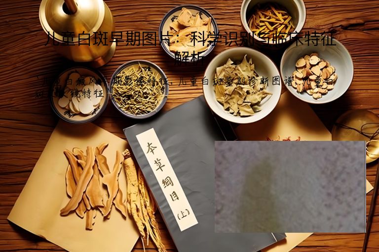 儿童白斑早期图片：科学识别与临床特征解析