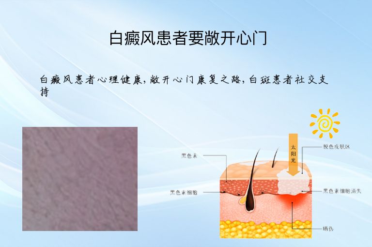 https://www.bdfsjzyy.com/d/file/p/5a638a10a8a8e312d516e0325985d505.jpeg