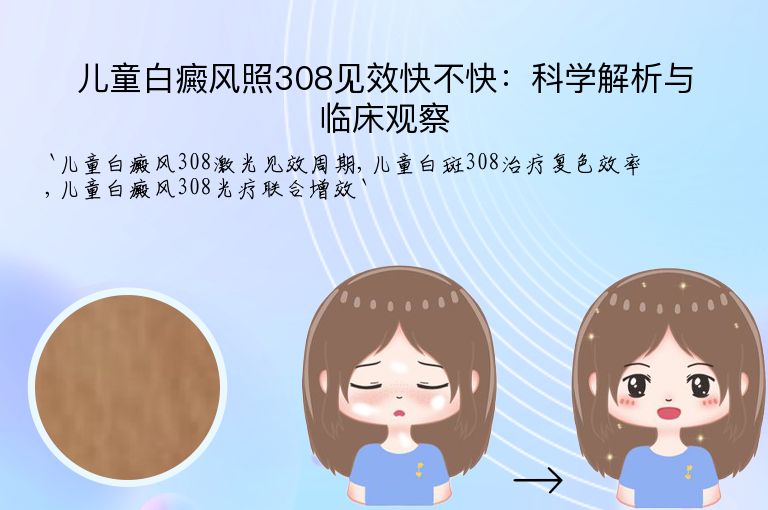 儿童白癜风照308见效快不快：科学解析与临床观察