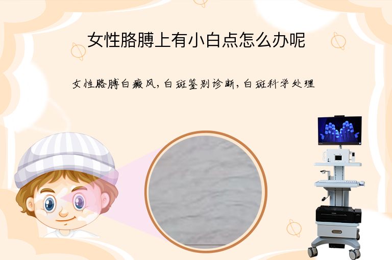https://www.bdfsjzyy.com/d/file/p/646abc74004d06f8ce74abcd79dcc920.jpeg