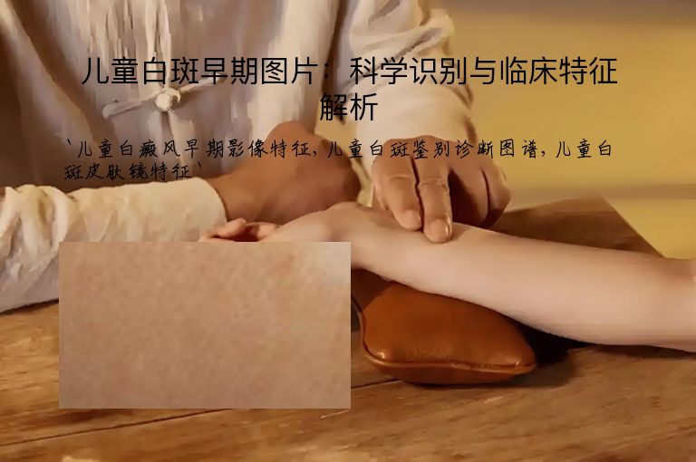 儿童白斑早期图片：科学识别与临床特征解析