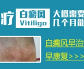 手部白癜风不严重哪种方法效果好”
