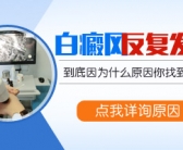 男孩手上有小白斑怎么处理