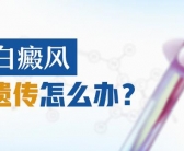 腋下长白斑中医能治好吗”