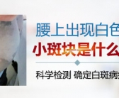 手上皮肤出现白斑适合哪种方法治疗”