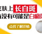 手上长了几个小白斑需要检查吗