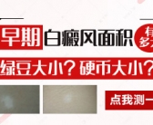 手上总是长小白斑要检查什么”