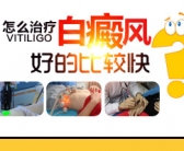 手上长了好多白斑怎么才能去除