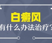 长在脸上的白癜风选择哪个方法效果才好”
