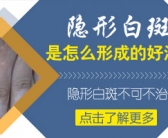 手背长白斑怎么处理