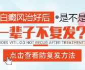 钢镚大的白癜风能快速治好”