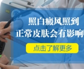 手背长了好多小白斑什么原因引起的