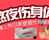 手上起白斑图片要检查什么