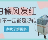 黑色素细胞培植治白癜风怎么样”