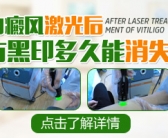 手背有小块白斑图片需要做什么检查”