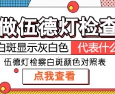 头上手上有小白斑咋回事”