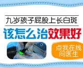 手上白斑怎么回事”