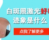 大片白癜风怎么治疗能快速康复”