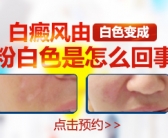 孩子身上有白癜风做308治疗每周照多少次”