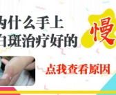 手上出小白斑需要用药吗