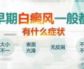 2022年治疗手上白癜风能看好吗”