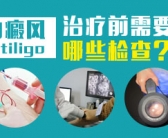 手上长了小白斑图要怎么才能祛除”