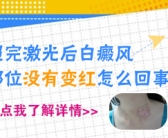 手上白斑图怎么能治好