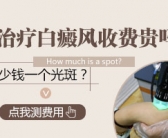 手上为什么有白斑要检查什么”