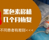 白癜风不是很严重如何治复发率低”