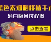 小孩手上有小白斑图片怎么办好”