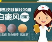 手上长了好多小白斑怎么能治好