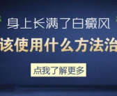 生下来手上有小白斑怎么处理