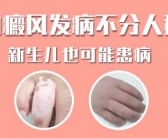 手上总是长小白斑咋回事