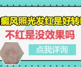 手上出白斑怎么能治好